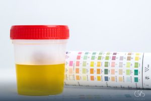 Cloudy Urine Causes: 7 Reasons for Urinary Appearance Changes