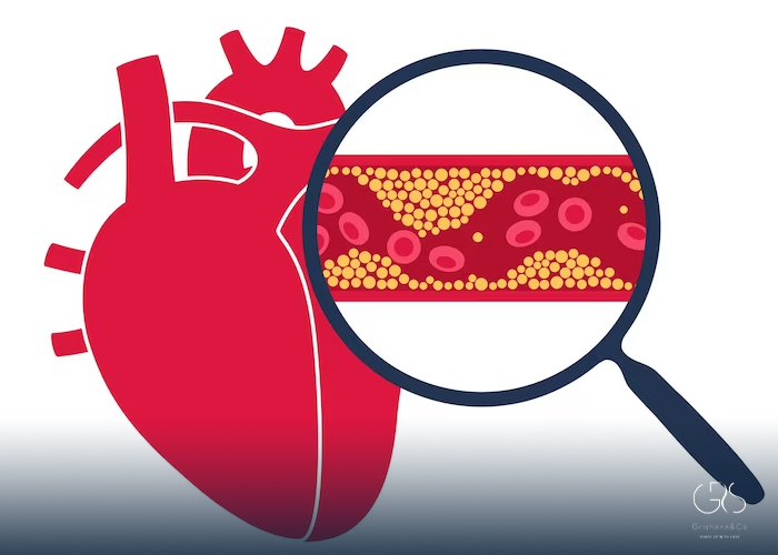 LDL cholesterol