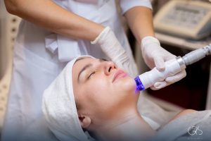 What is Microdermabrasion?