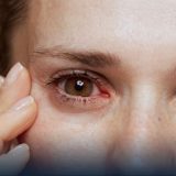 Pink Eye Treatments: A Comprehensive Guide