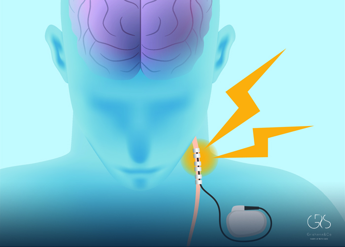 Vagus Stimulation Benefits