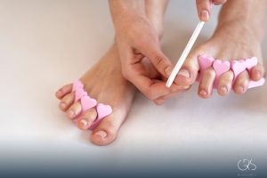 Prevent Ingrown Toenails Strategies