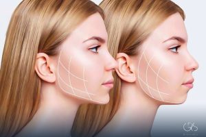 Mewing Analysis: Facial Reshaping Insights